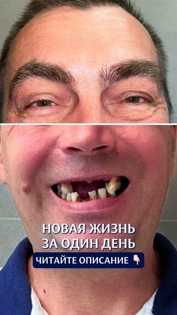 Кейс пациента