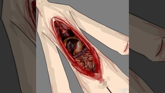 Со мной ничего не случилось: