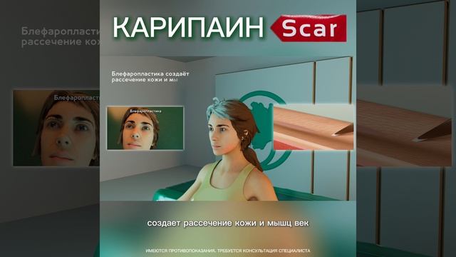 КАРИПАИН скар