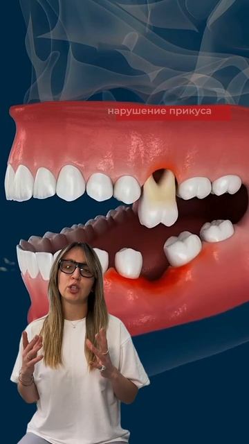 Что будет, если удалить зуб