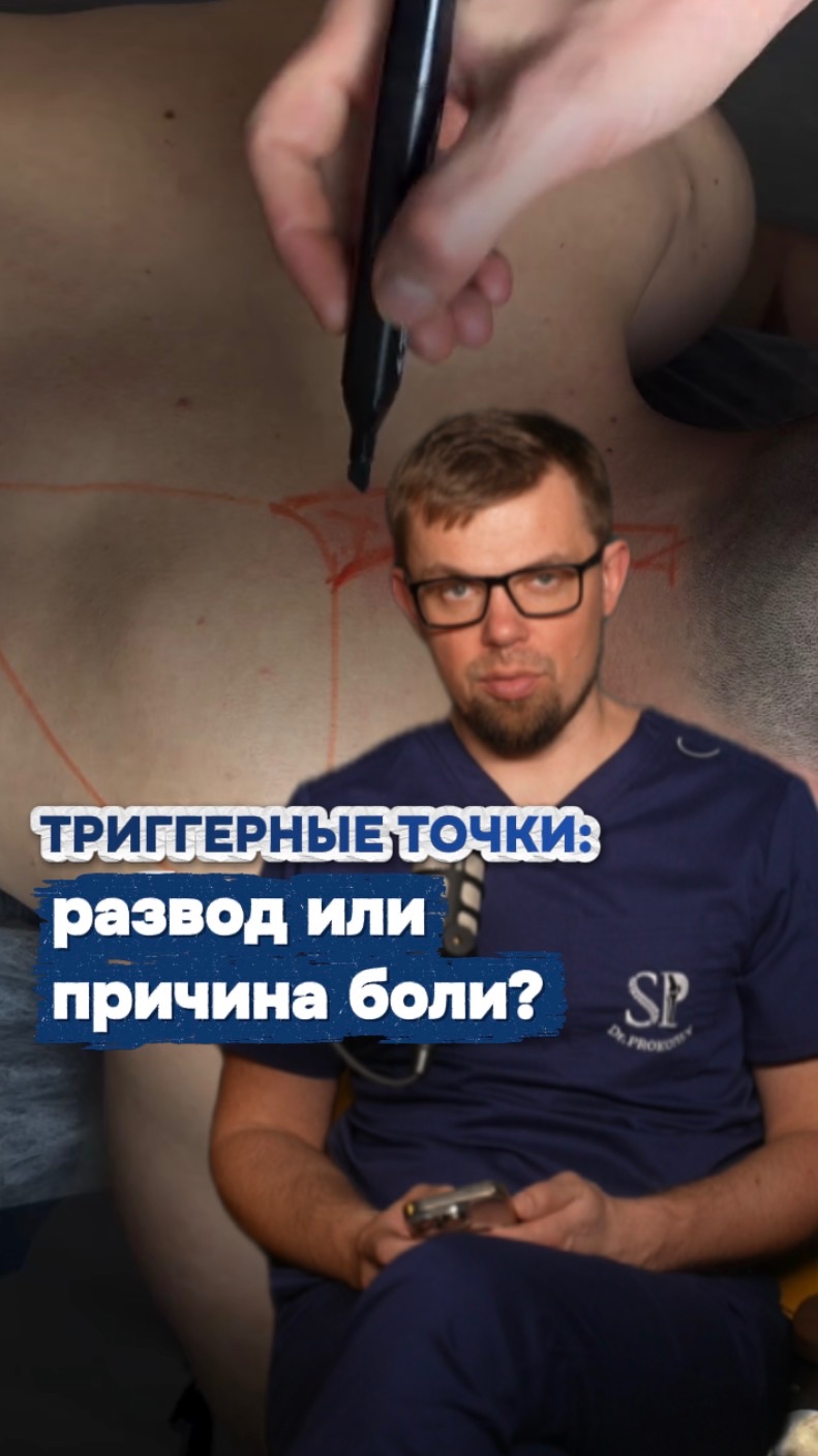 Триггерные точки: развод или причина боли?