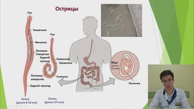 Энтеробиоз ч. 1