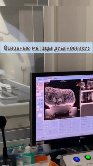Ранняя диагногстика рака легких