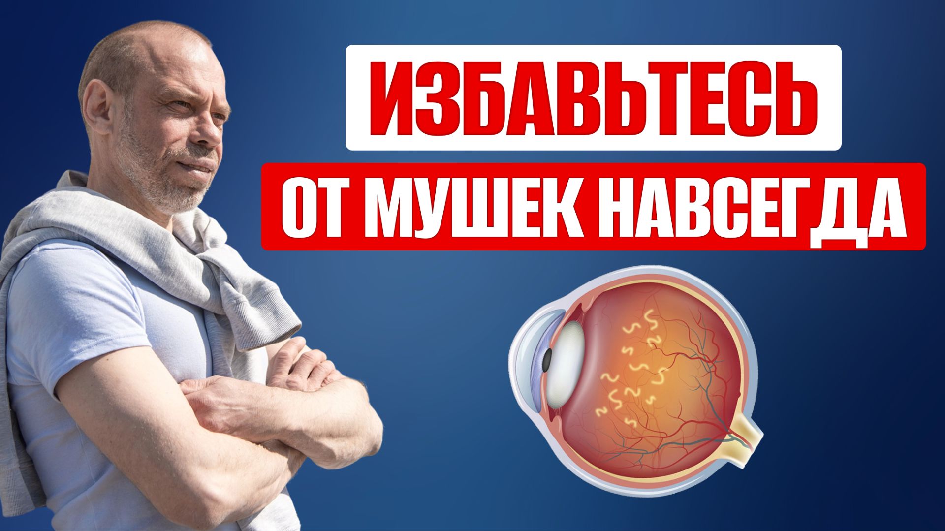 Как НАВСЕГДА избавиться от МУШЕК в глазах без лазера и операции?