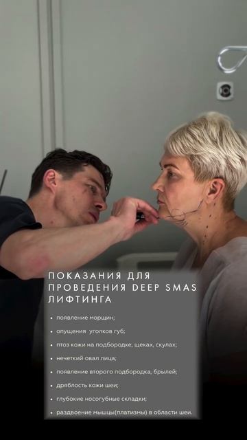 Deep Smas лифтинг — глубокая подтяжка лица: показания к проведению операции!