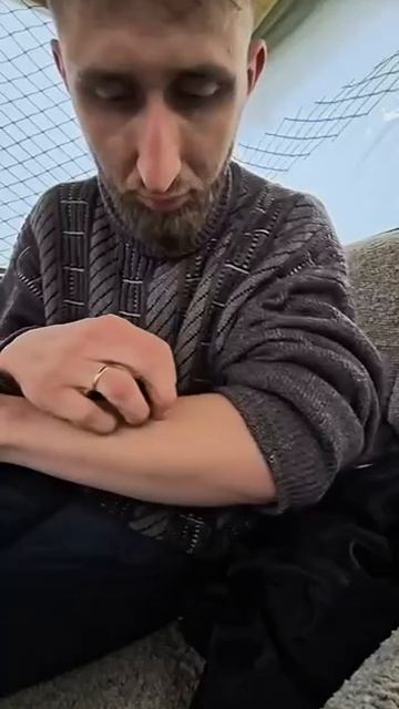 Мужчина в качестве эксперимента показал, что будет с рукой, если хоть немного задеть борщевик