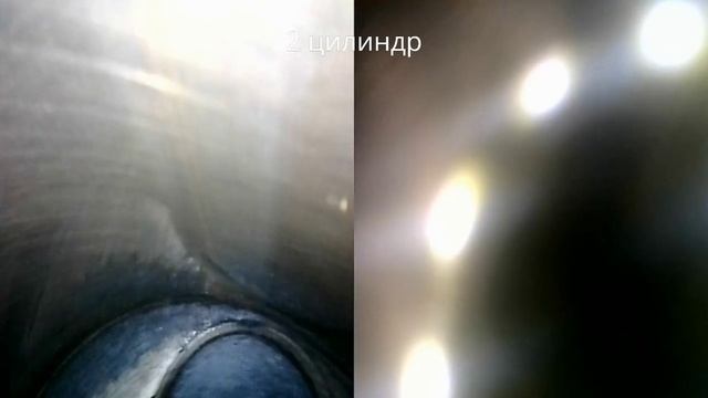 АРТ-2927 Эндоскопия