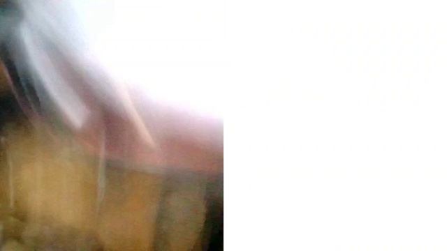 донор 001 эндоскопия АРТ 5675