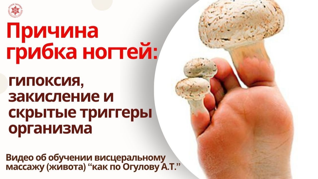 Причина грибка ногтей: гипоксия, закисление и скрытые триггеры организма. Видео об обучении