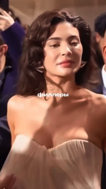 КАКИЕ ПОСЛЕДСТВИЯ ОТ ФИЛЛЕРОВ? 😱