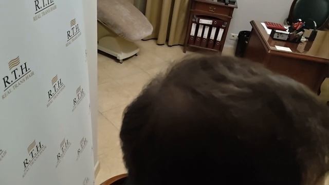 6 месяцев после пересадки: пациент заглянул к хирургу показать, что выросло!