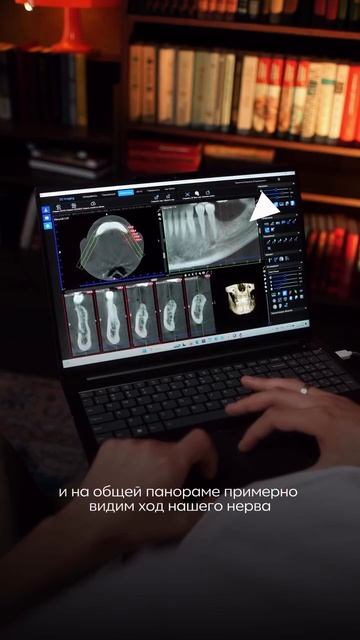 Как не потерять нижнечелюстной канал на КЛКТ