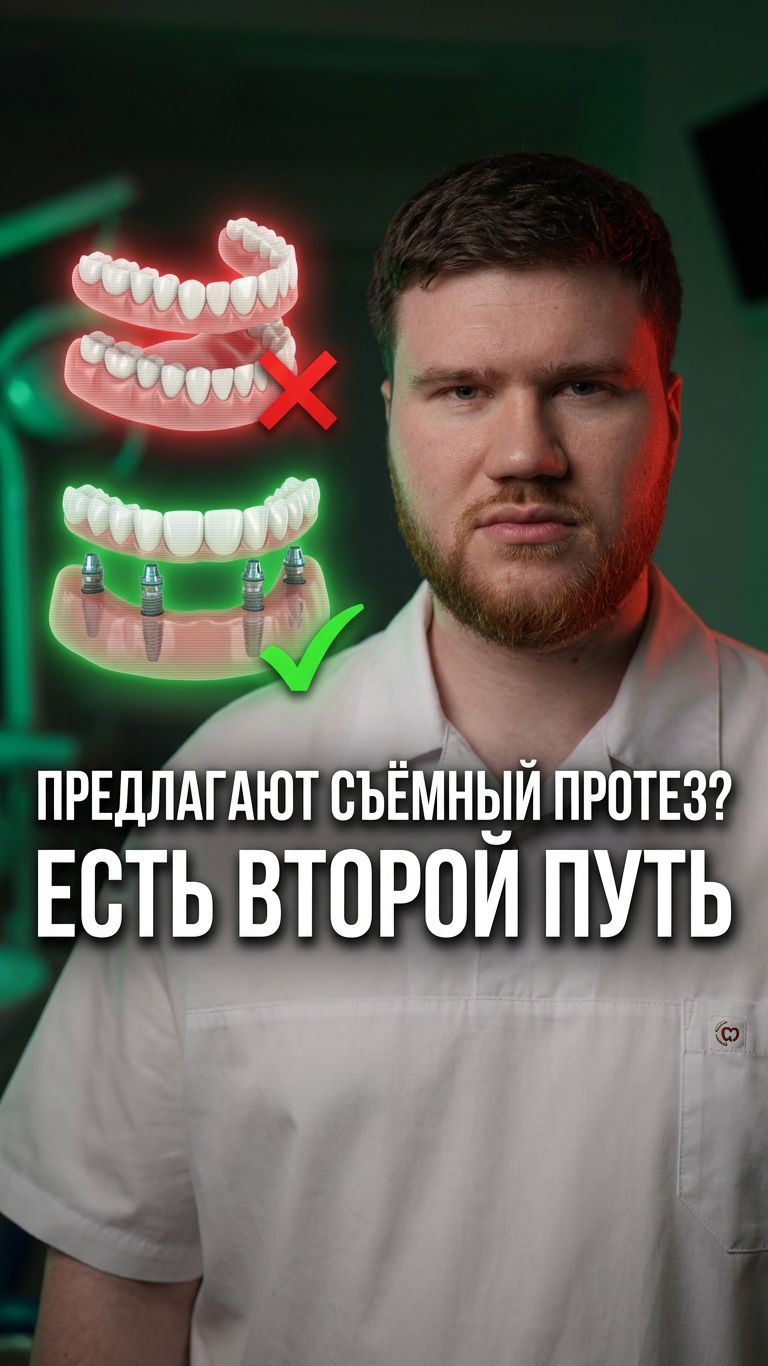 All-on-4 за день: почему съёмный протез разрушает оставшиеся зубы