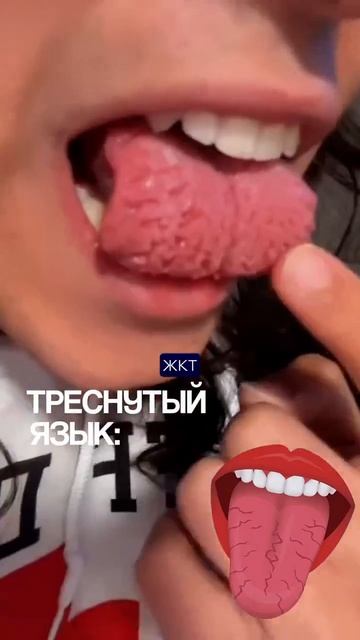 Внешний вид языка