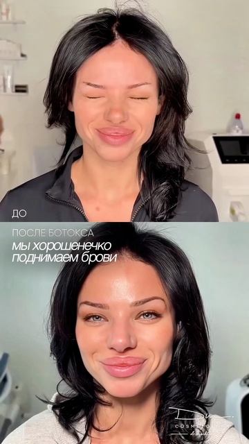 Ботокс для всего