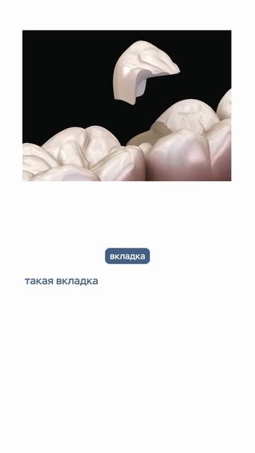 Вкладки вместо коронок