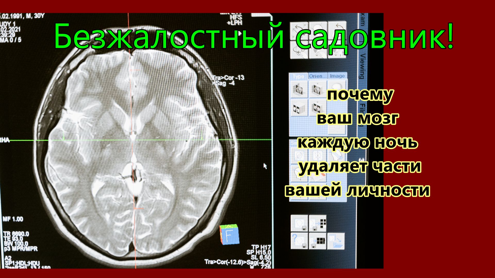 Каждую ночь ваш мозг стирает 18% вас. Вот как это работает.