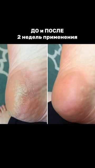 арт.#474634773