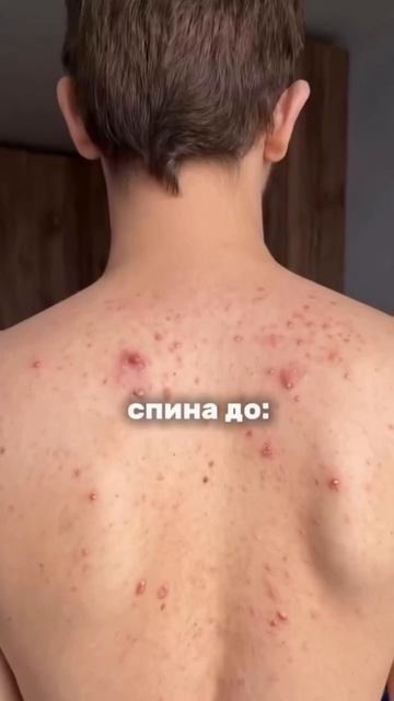 арт.#858400246