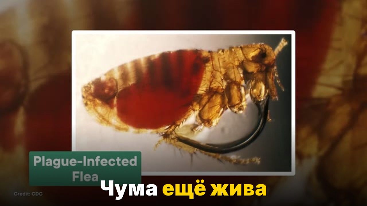 Чуме 5000 лет — и она до сих пор не побеждена