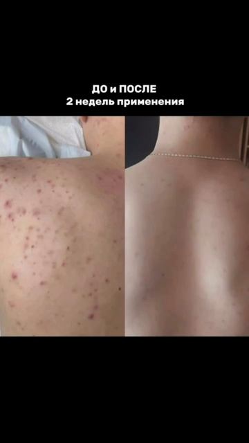 арт#504776238