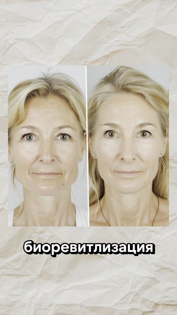Обязательны ли уколы после 40?