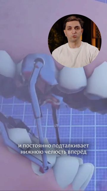 А вы знали про такой стоматологический аппарат