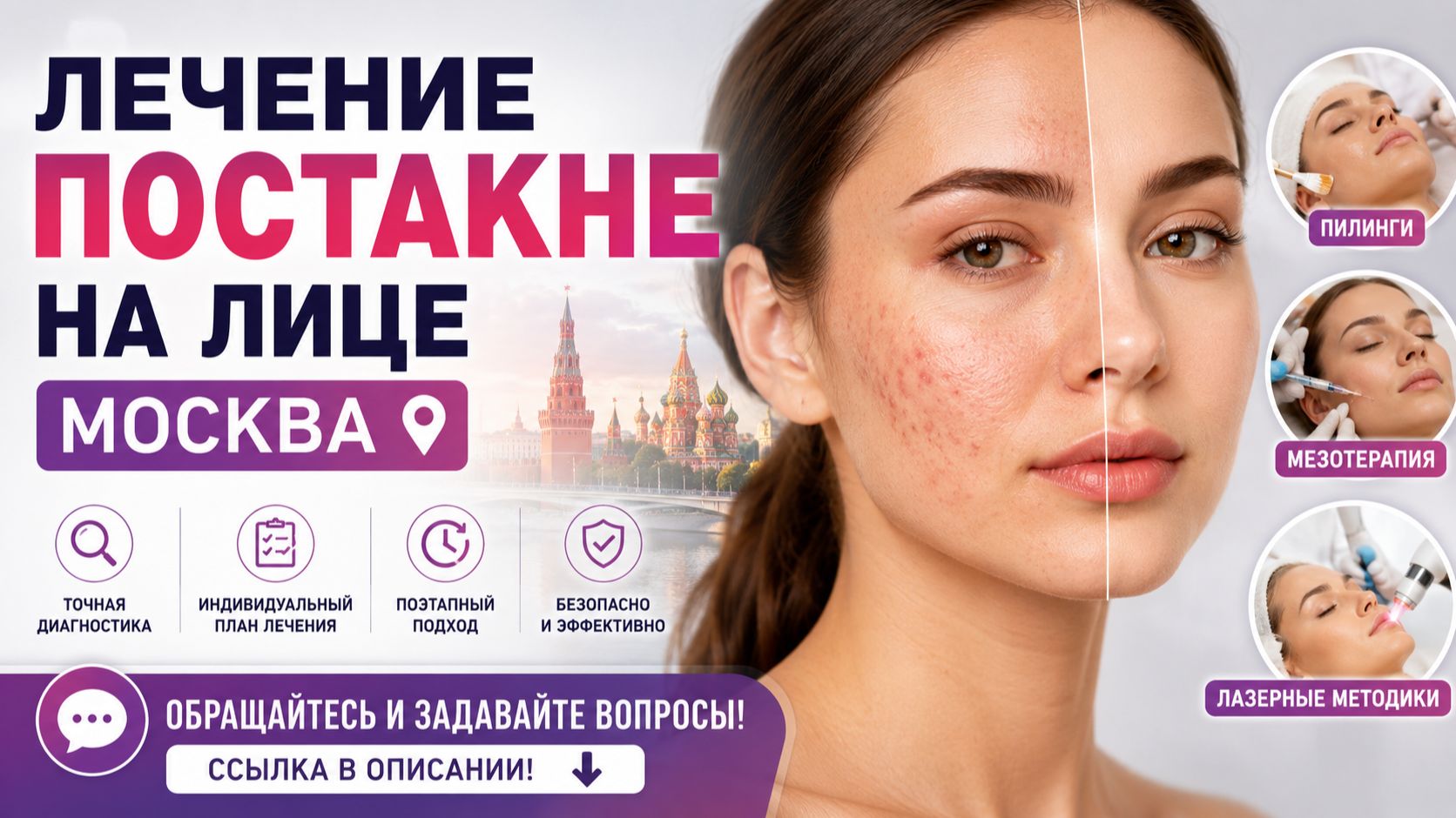 Лечение постакне на лице Москва