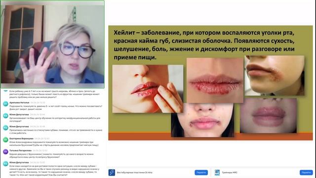 Использование трейнеров Myobrace и вестибулярных пластинок Dr. Hinz для коррекции нарушений жевания