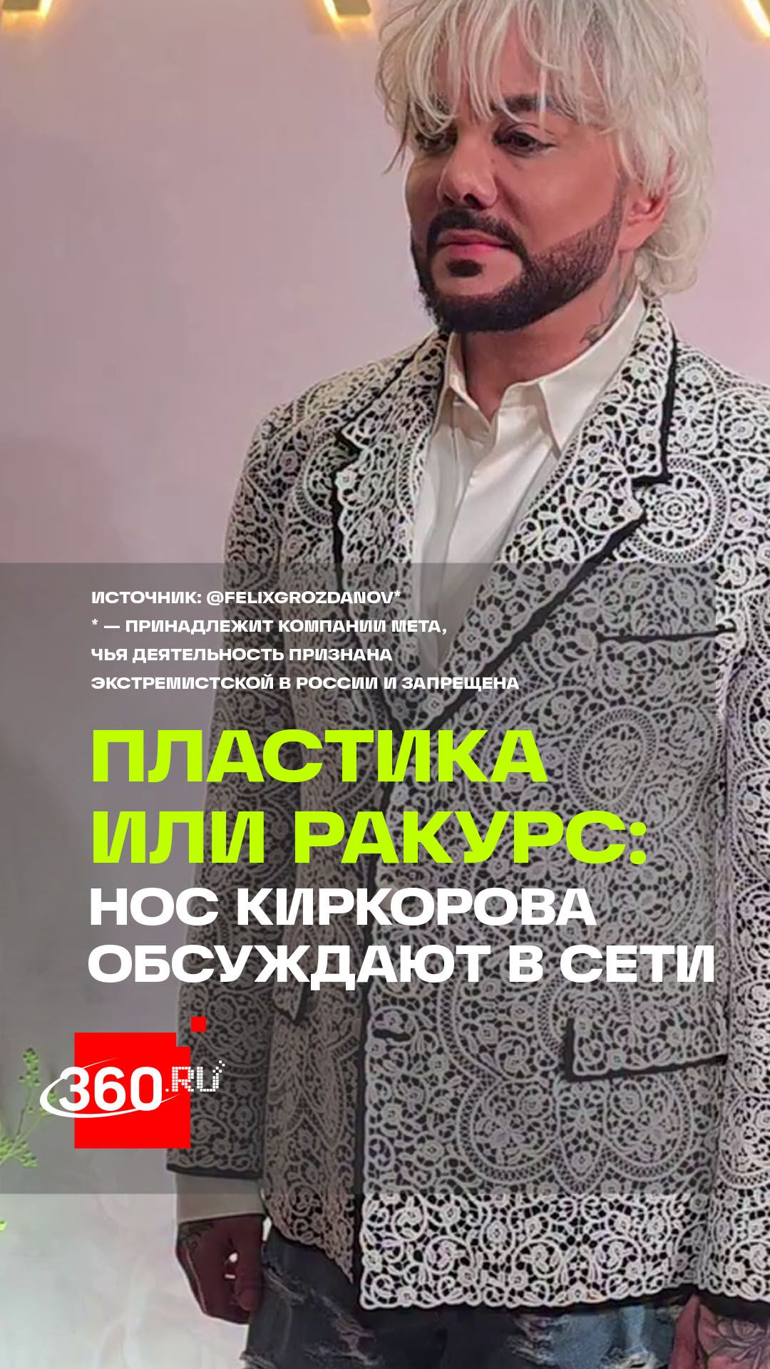 Интернет-пользователи заметили изменения во внешнем облике поп-короля российской эстрады