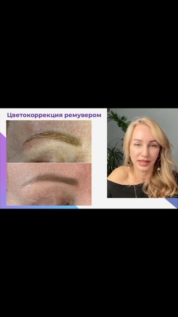 Рекомендации