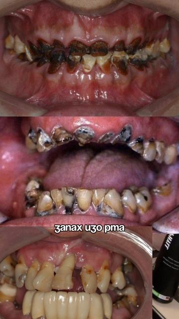 Проблемы с желудком всегда бьют по внешности…