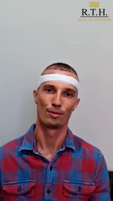 Реальный отзыв пациента сразу после пересадки волос у Ивана Двинских!