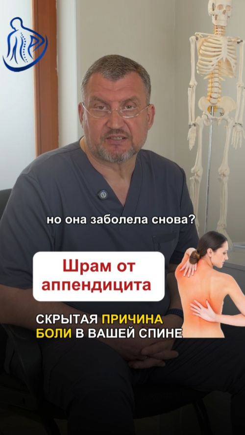 🔪 ШРАМ ОТ АППЕНДИЦИТА — СКРЫТАЯ ПРИЧИНА БОЛИ В СПИНЕ