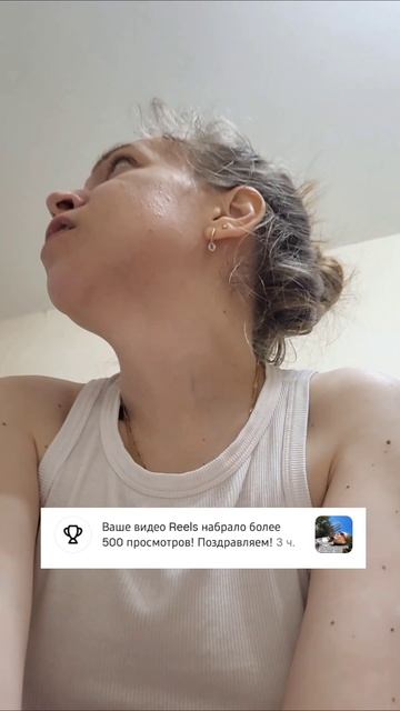 восстанавливаюсь после ортогнатии в инсте @anna_kuz94. Вся история в Актуальном Ортогнатия🍿