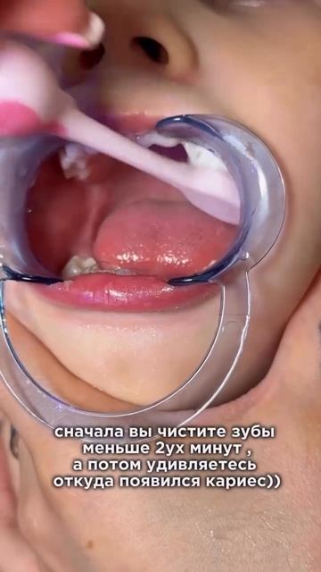 А вот монопучок справляется на ура!
#WW431173/ озон 4140957619
УЗ