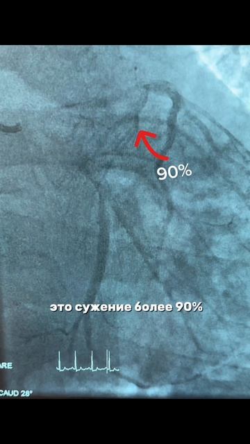 Случай из операционной