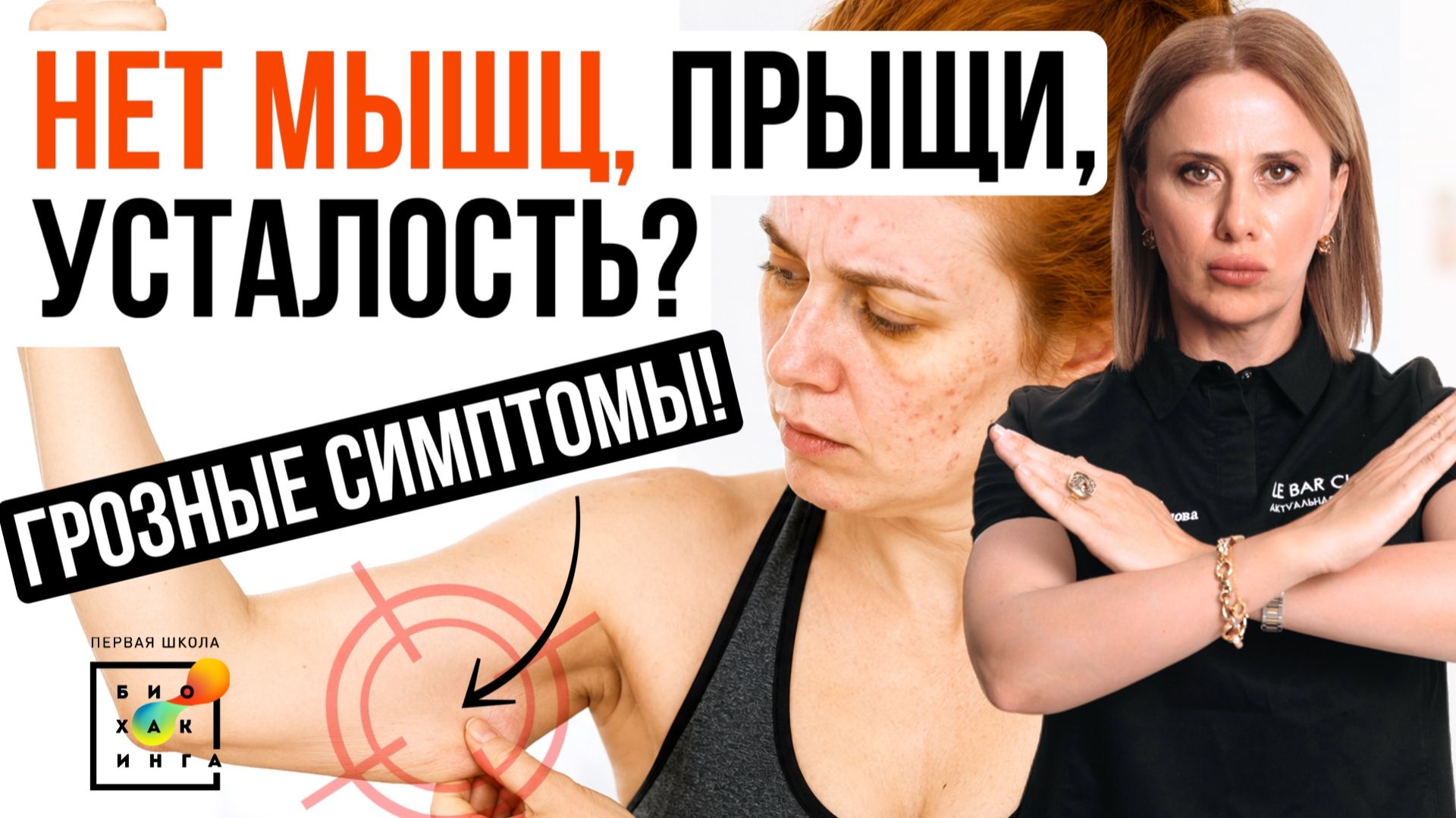 Боли в животе, смены настроения, проблемы с кожей - признаки синдрома Жильбера #иринабаранова #пшб