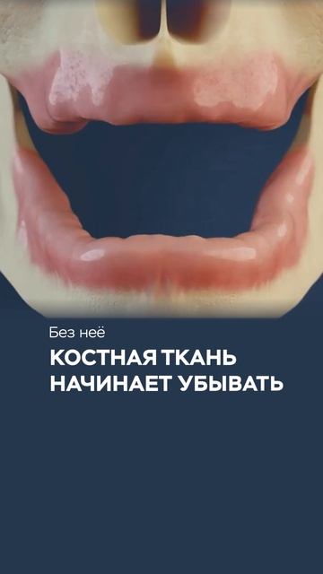 Избегайте этого метода протезирования