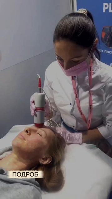 На видео проработка аппаратом СФТ, после процедуры холодной плазмы.