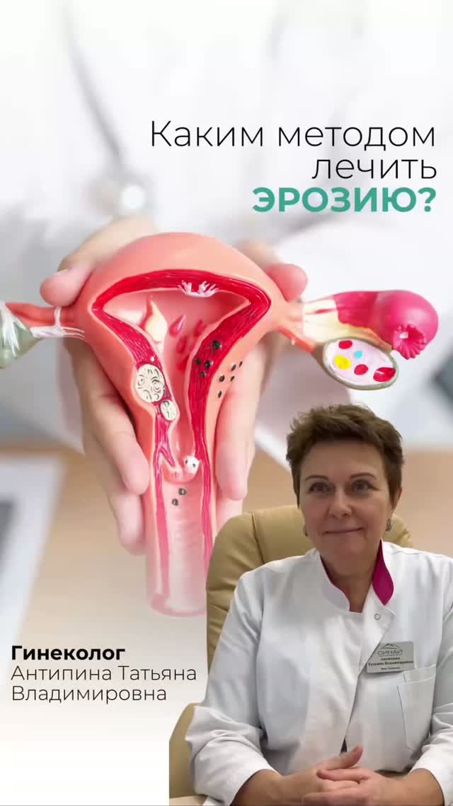 ЧТО ТАКОЕ ЭРОЗИЯ ШЕЙКИ МАТКИ И КАК ЕЕ ЛЕЧИТЬ | ГИНЕКОЛОГ АНТИПИНА ТАТЬЯНА ВЛАДИМИРОВНА