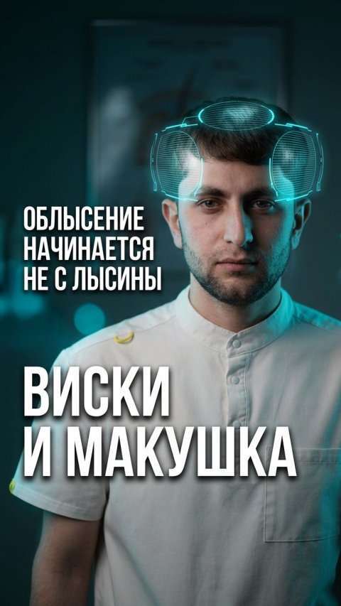 Редеют виски и макушка? Лосьоны против мужского облысения до трансплантации
