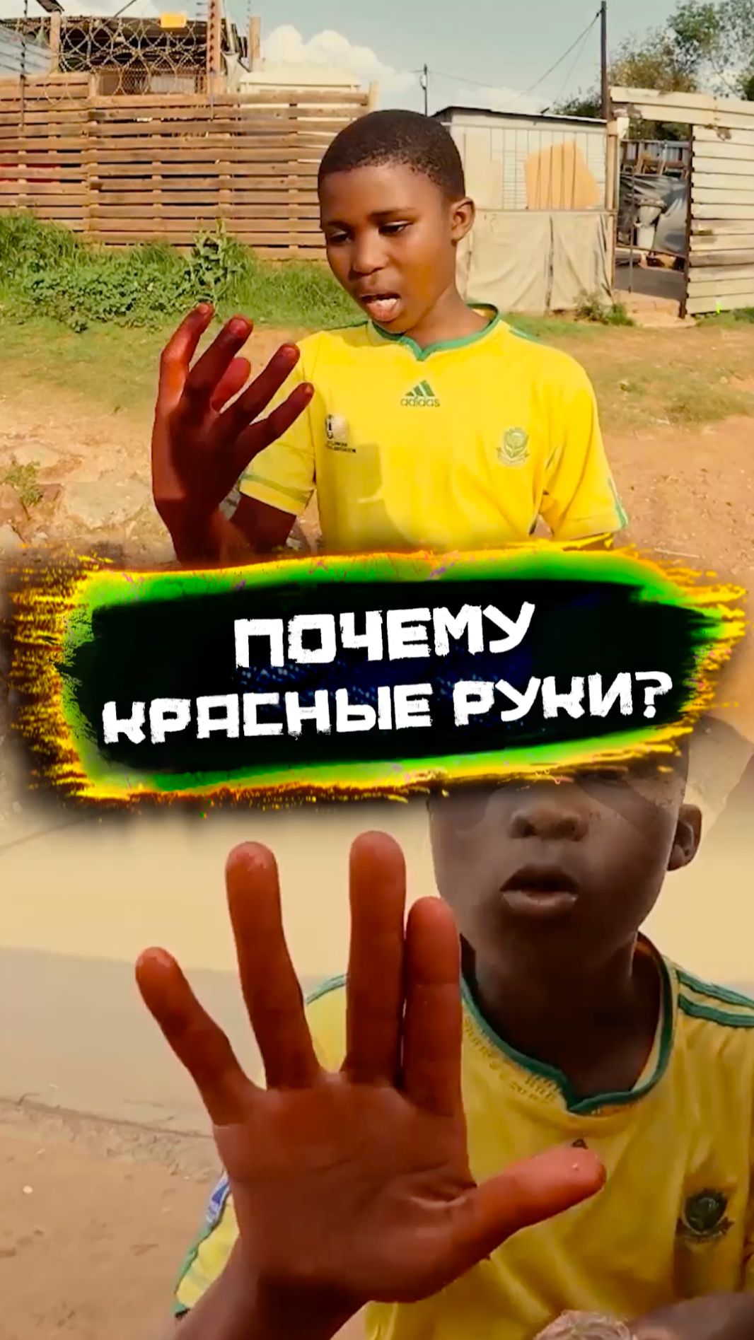 Почему руки красные?