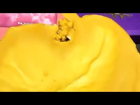 Диагностика на воске. Погост, сущность