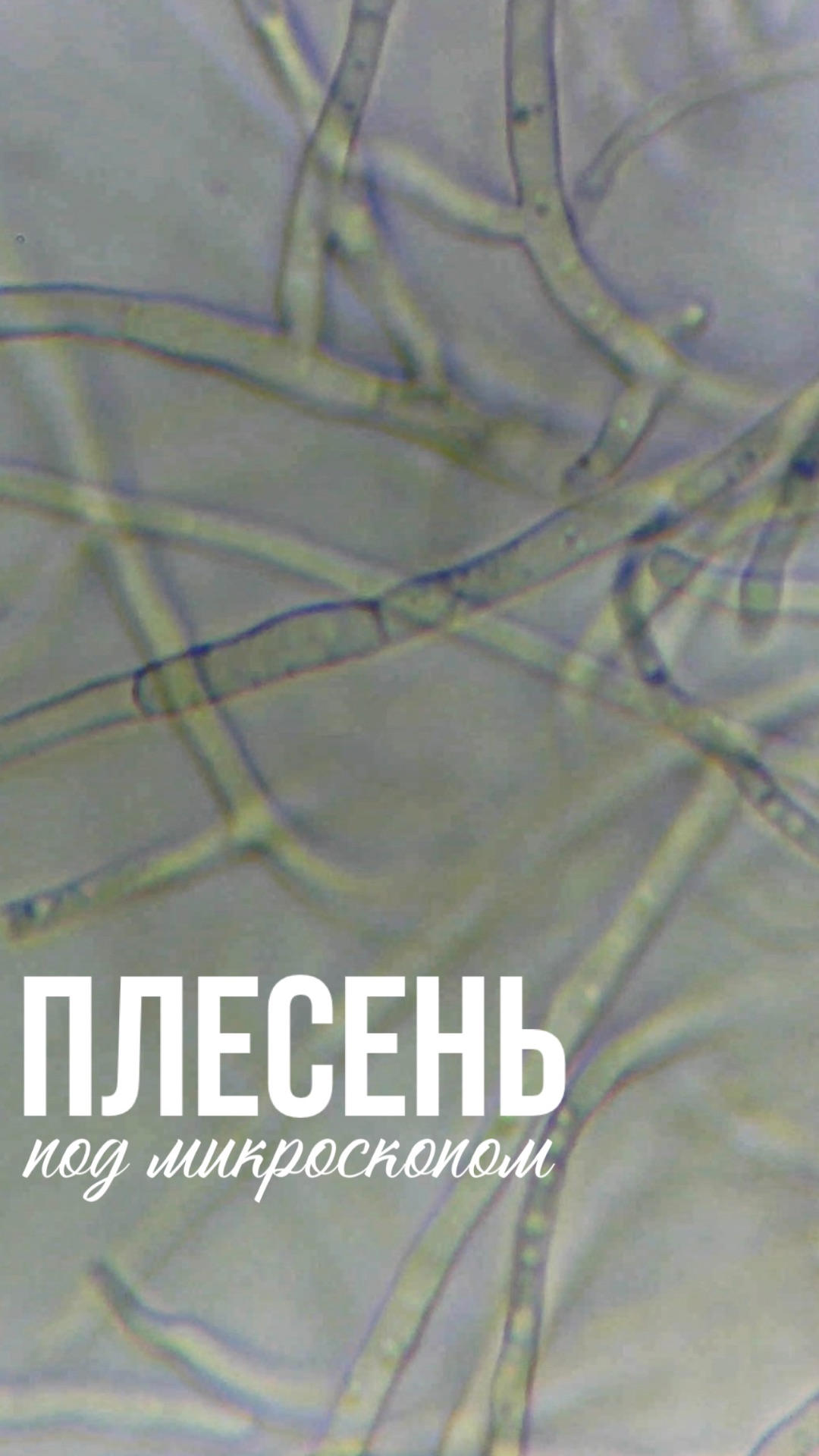 Плесень под микроскопом 🔬
