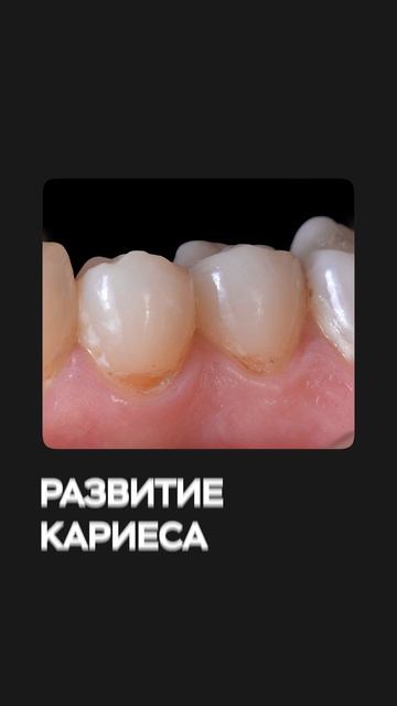 Эти проблемы появятся, если Вы будете использовать электронные сигареты год