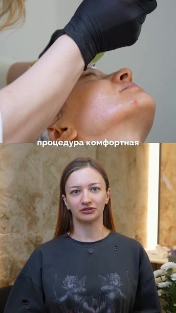 Как вам результат сразу после процедуры?