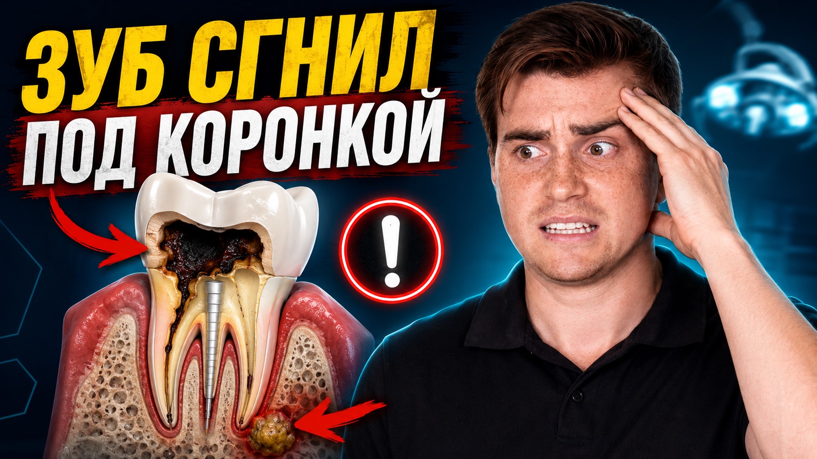 Как достать металлическую вкладку из зуба? Под коронкой разрушился зуб и выросла киста