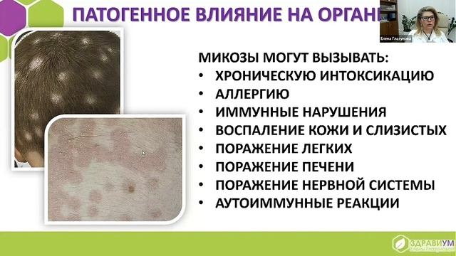 Как грибы влияют на ваш организм?