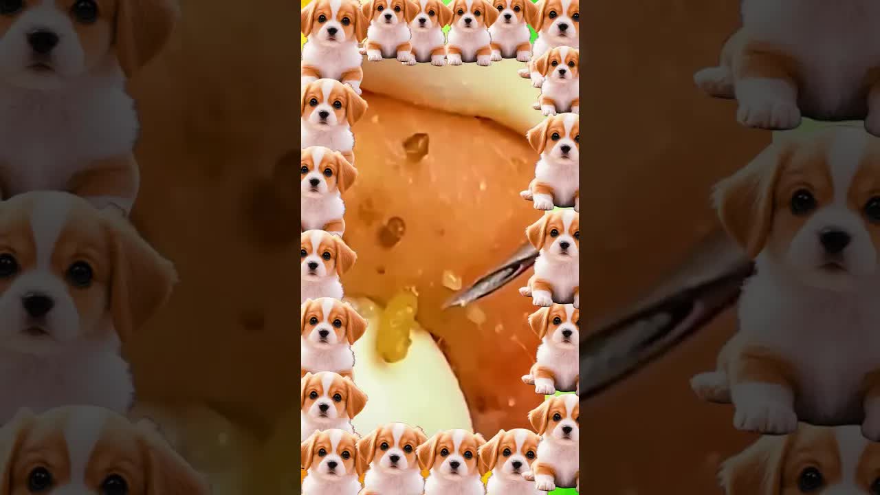 Удаление черных точек и прыщей | Очень удовлетворительное видео 💥